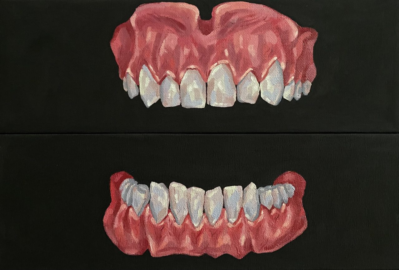 Rinne Oliver Lawrence