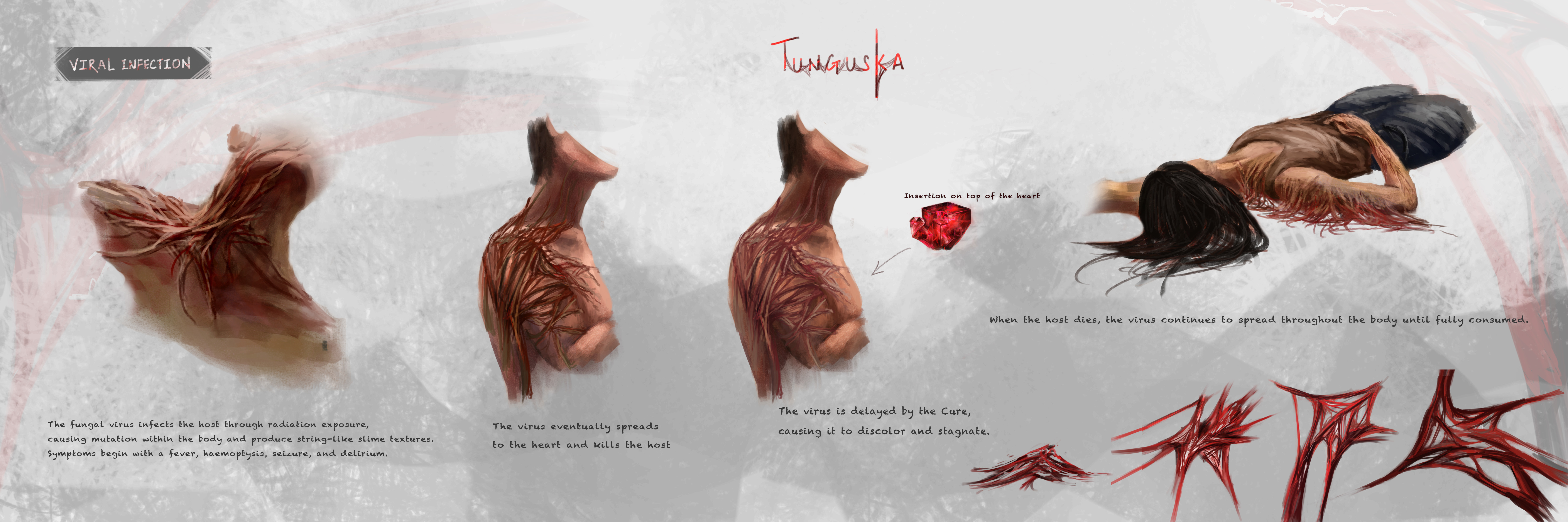 Infection